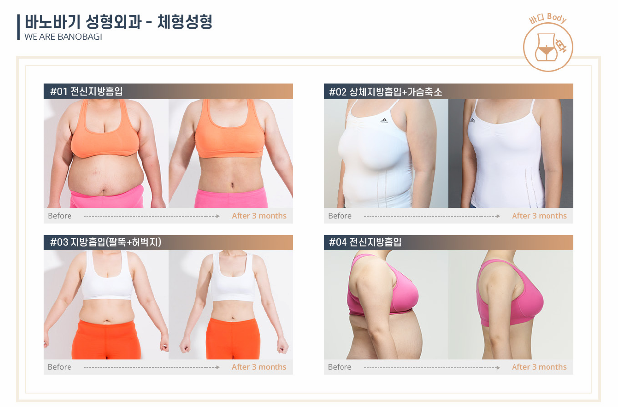 제품사진
