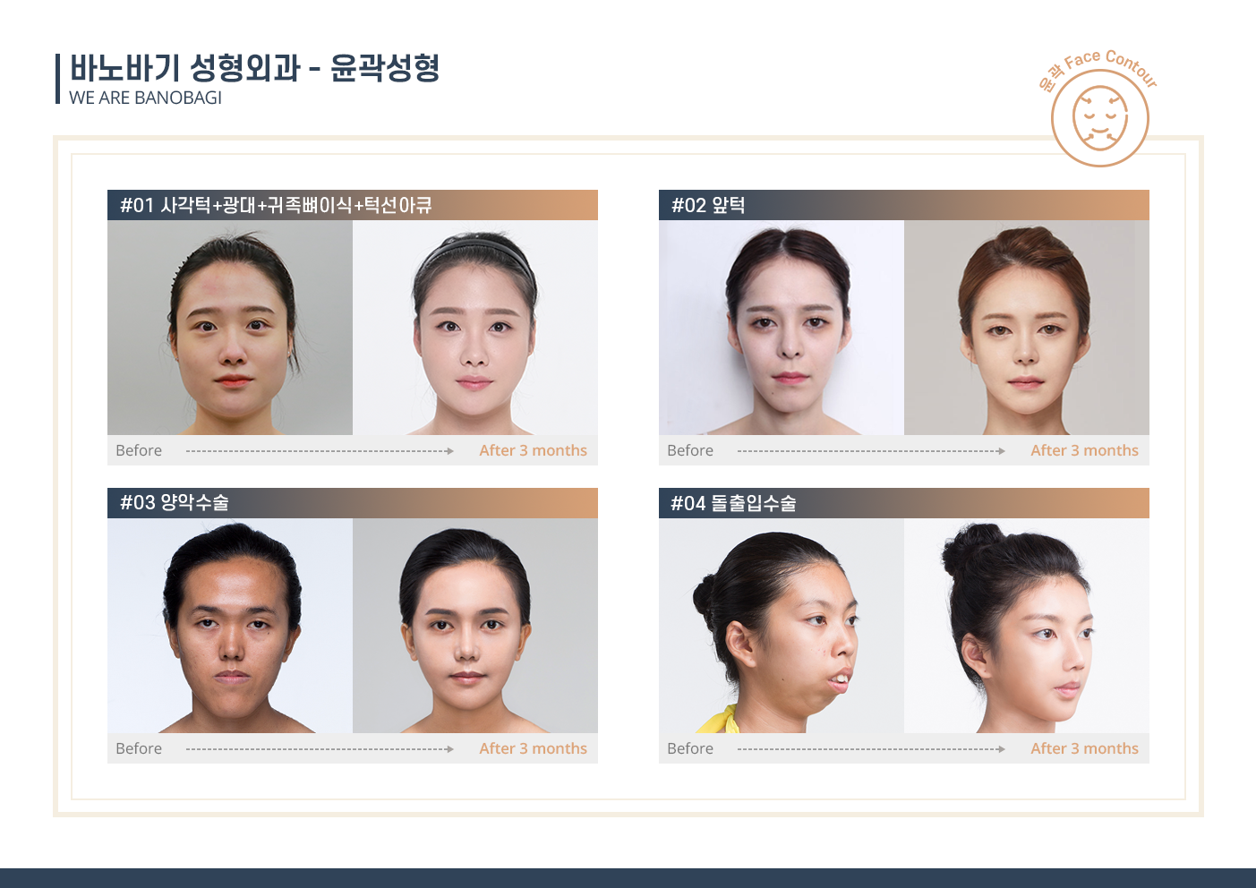 제품사진